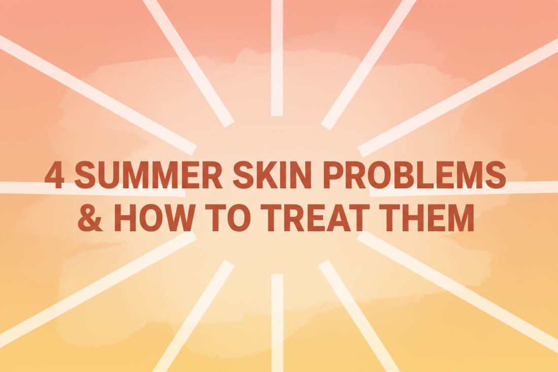 4 Summer Skin Problems & How to Treat Them